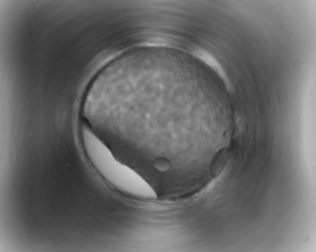 X0000088471138200706051337