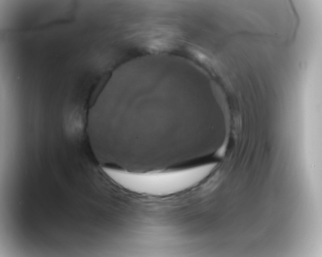 X0000088471300200706051335