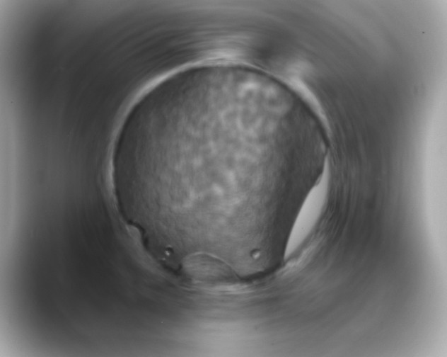 X0000088471336200706051335