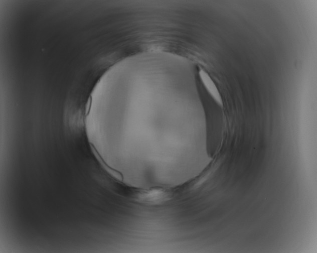 X0000088470431200706191351