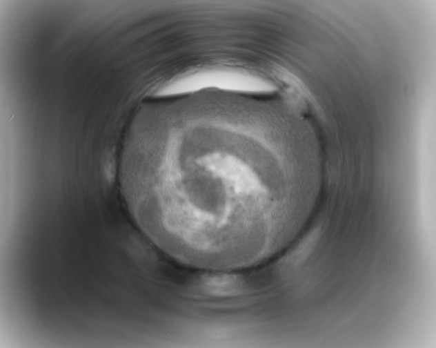 X0000088480833200706051359
