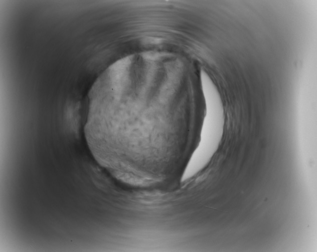 X0000088480868200706051358