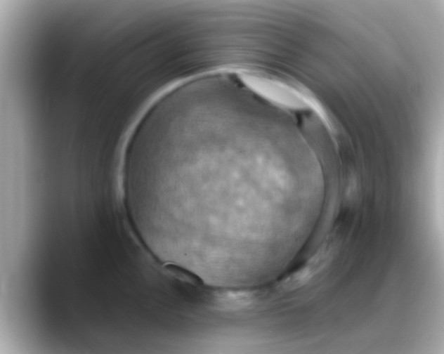 X0000088481148200706051356