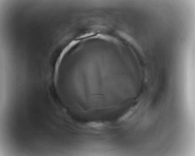 X0000088481399200706051352