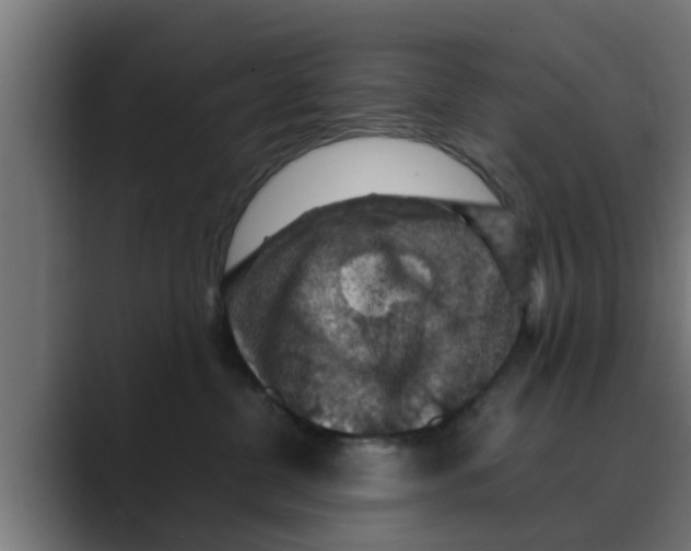 X0000088480380200706191411