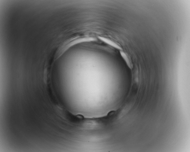 X0000088490519200706051420