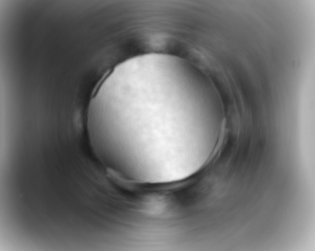 X0000088490562200706051420