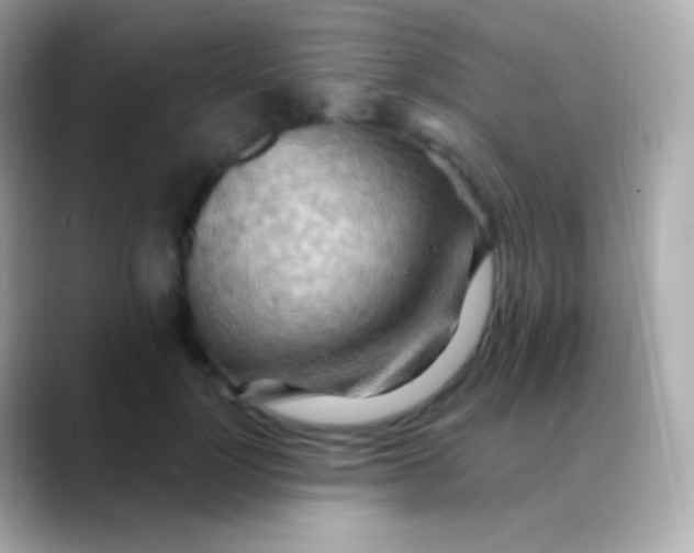 X0000088490748200706051418