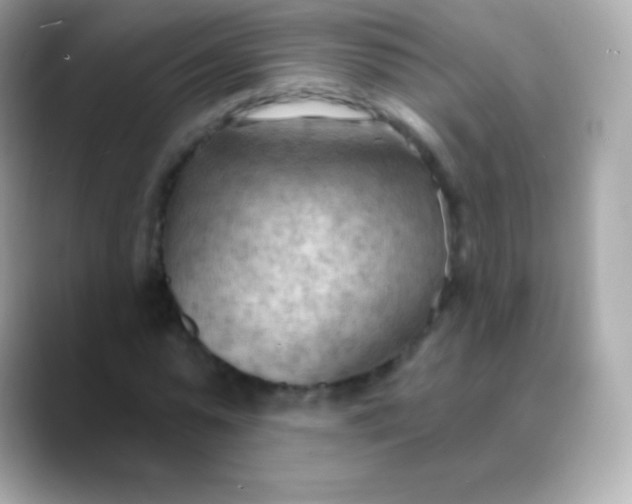 X0000088490775200706051417