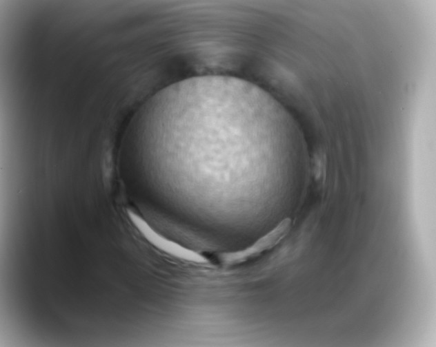 X0000088490915200706051415