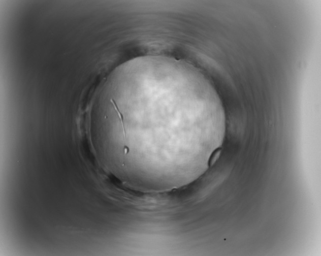 X0000088491346200706051411