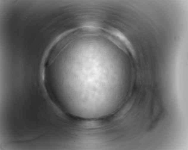 X0000088491376200706051410