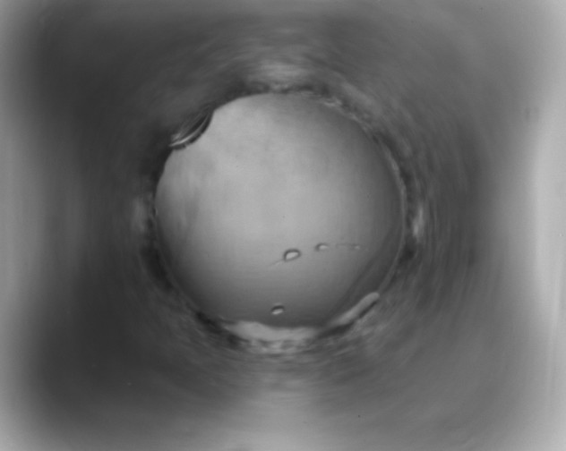 X0000088491397200706051410