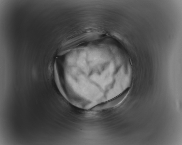 X0000088490192200706191431