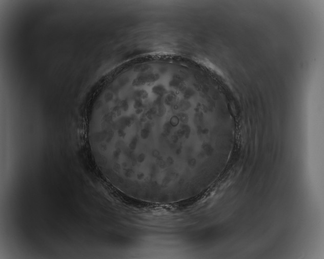 X0000088571255200705251111