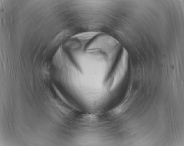 X0000088570140200706081107