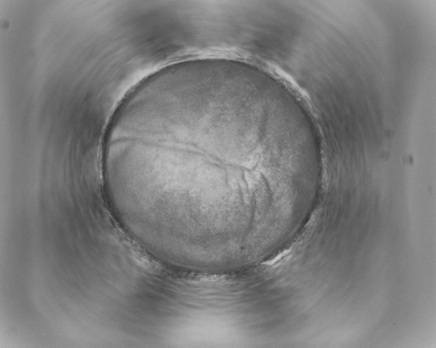 X0000088571174200706151639