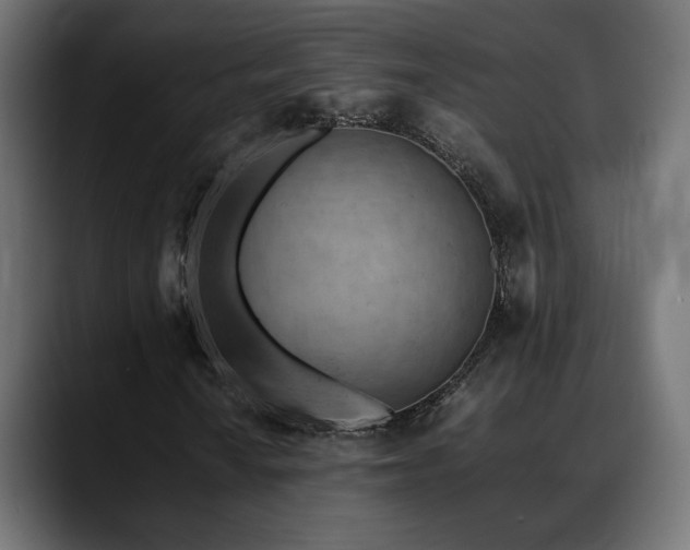 X0000088581010200705251133