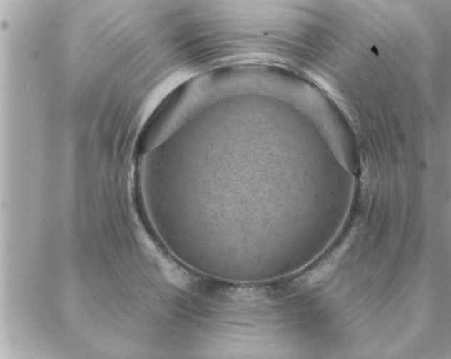 X0000088581418200706011101