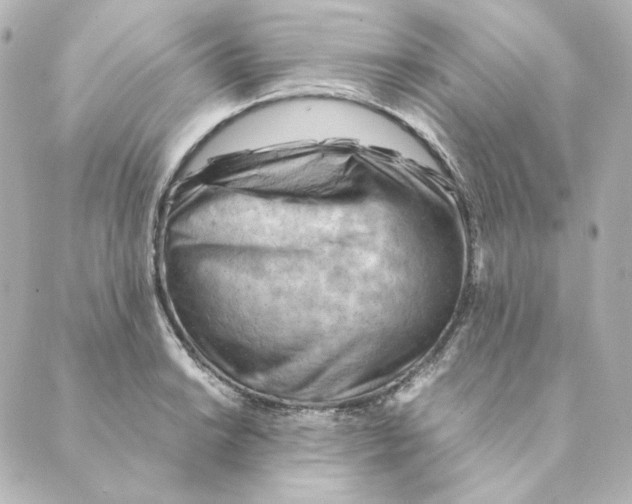 X0000088581038200706221311