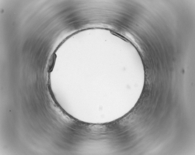 X0000088581140200706221310