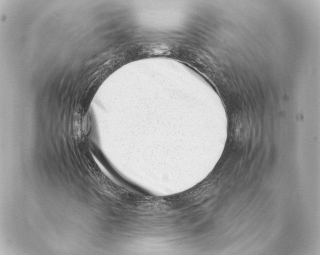 X0000088581442200706221304