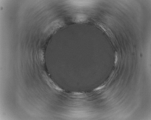 X0000088590380200705251155