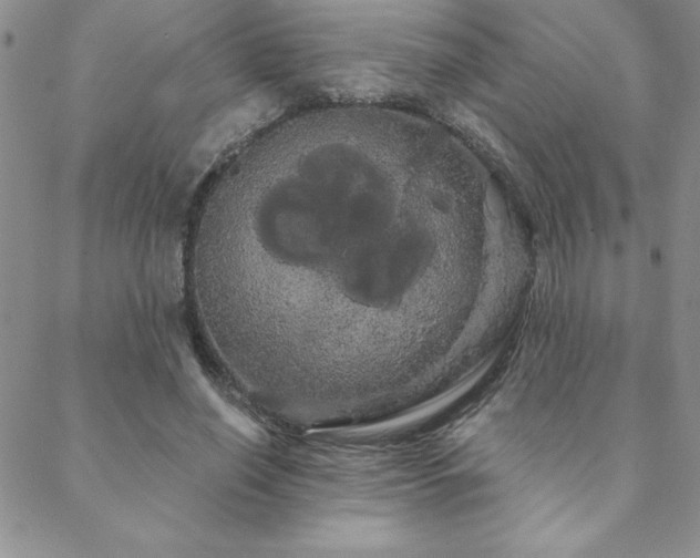 X0000088590638200705251150