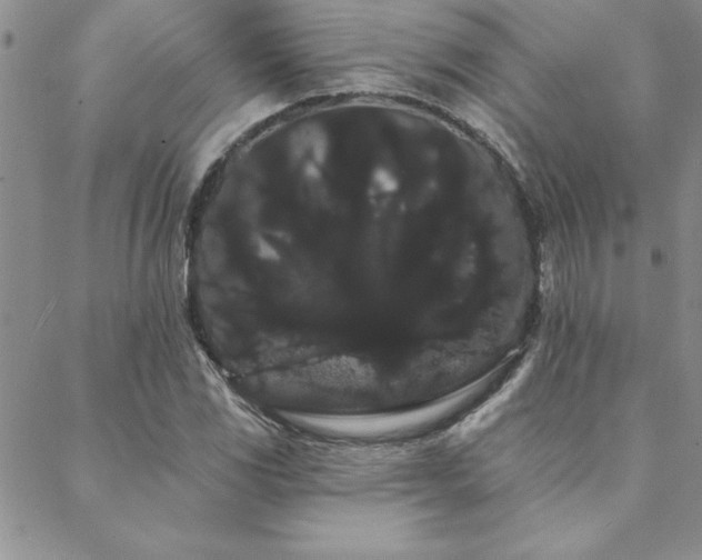 X0000088591117200705251142