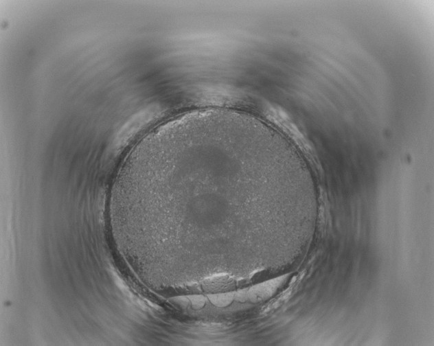 X0000088590058200706011148