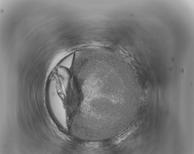 X0000088590102200706011148