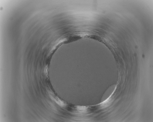 X0000088590144200706011147