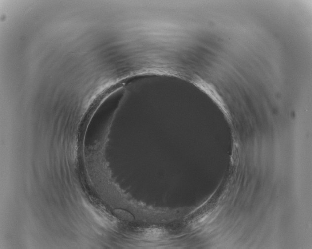 X0000088590204200706011146