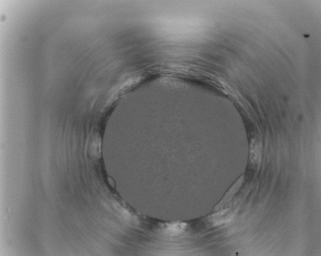 X0000088590474200706011142