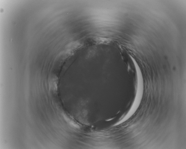 X0000088590570200706011140