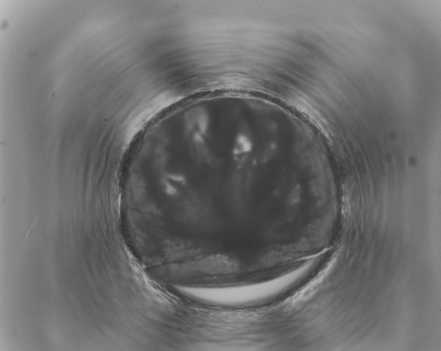 X0000088591117200706011131