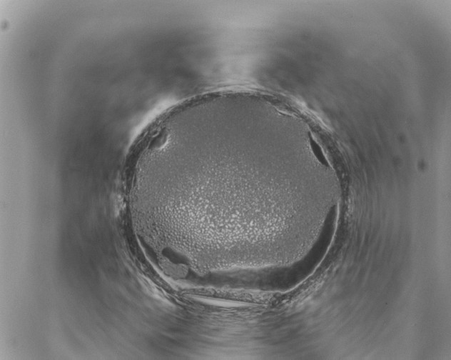 X0000088591400200706011126