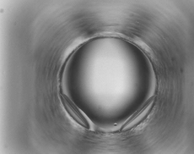 X0000088591430200706011126