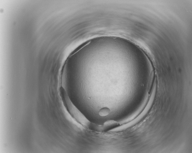 X0000088591528200706011125