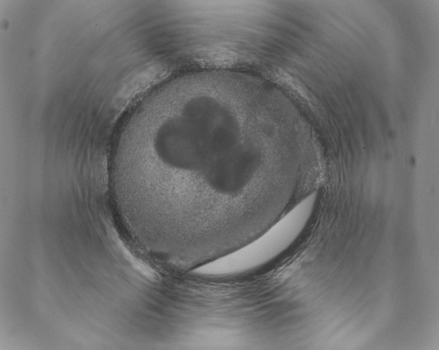 X0000088590638200706081329