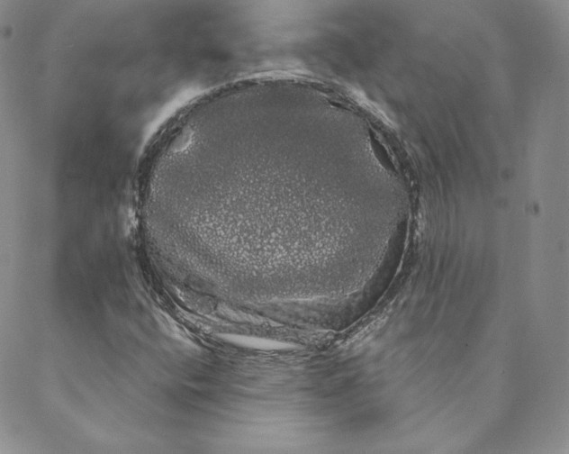 X0000088591400200706081316