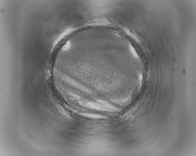 X0000088591400200706151725