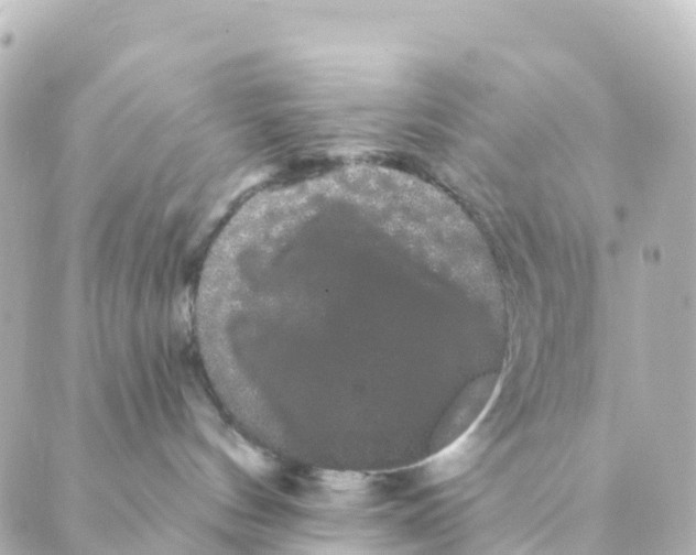 X0000088590144200706221350