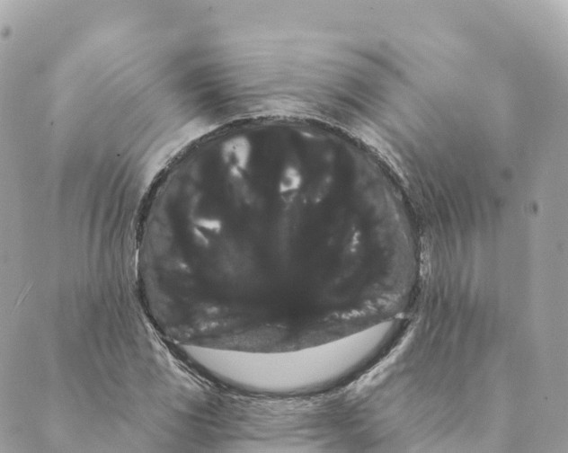 X0000088591117200706221334