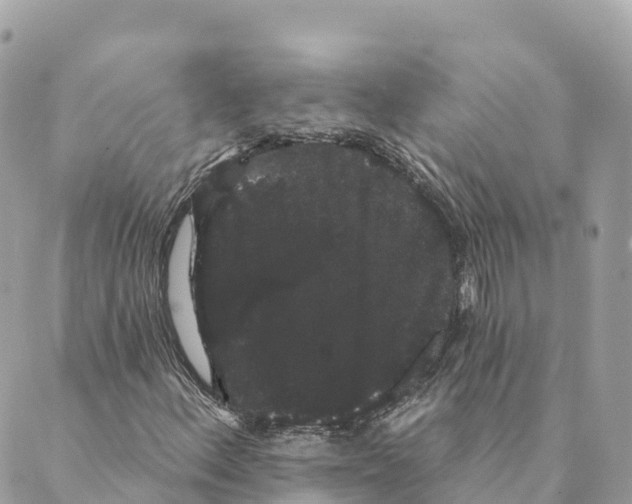 X0000088591156200706221334