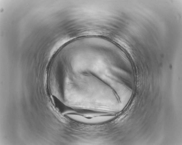 X0000088601179200706221358