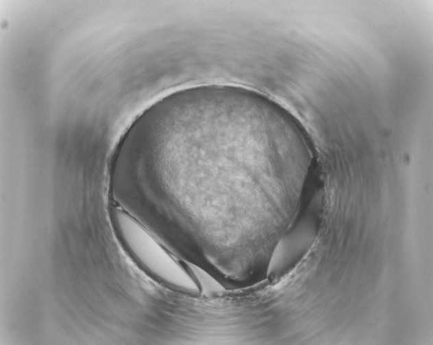 X0000088601508200706221353