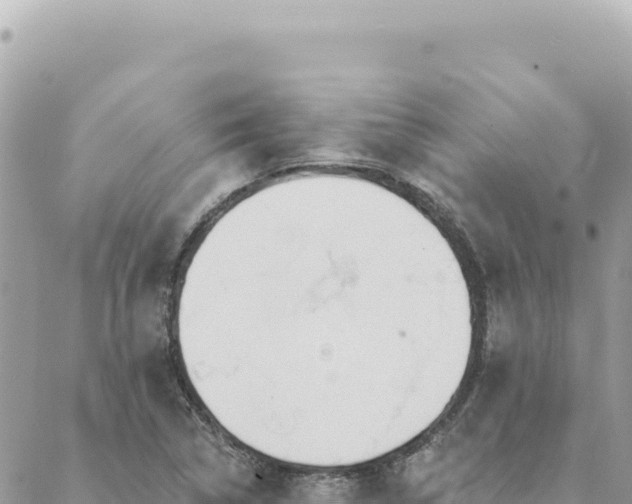 X0000088611314200706011218