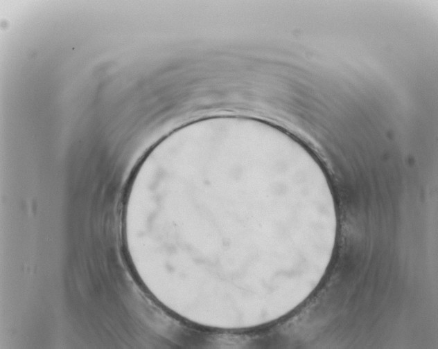 X0000088611514200706011215