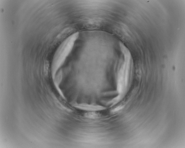 X0000088610231200706151835